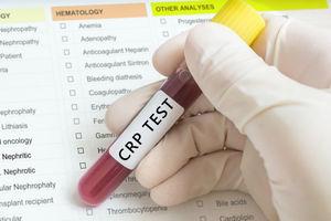 Vyšetrenie CRP sa môže opakovať aj počas liečby na overenie toho, či antibiotiká zaberajú.