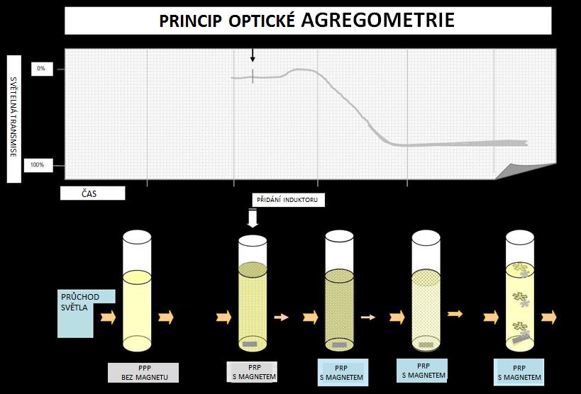 Obrázek 5: Princip optické agegometrie. (42) (Upraveno dle http://www.practical-haemostasis.com/platelets/platelet_function _testing_lta.html.