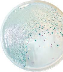 Obrázek č. 5 : Chromogenní agar COLOREX Candida (foto výrobce) 2.