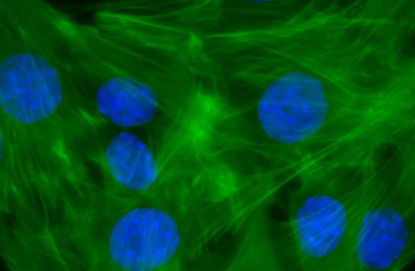 Obr. 7 Phalloidin FITC s dobarvením jader pomocí DAPI - dobarvení aktinu v myších myoblastech. Foceno při zvětšení 60x (foto: autor).