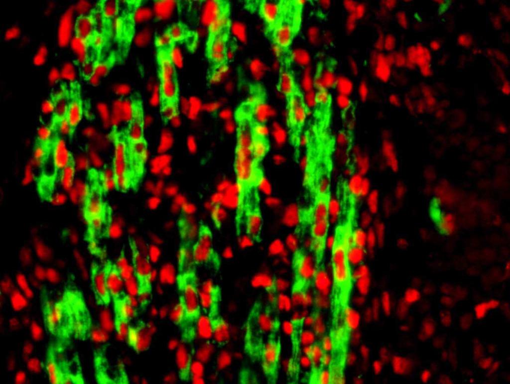 Obr. 22 Amplifikace signálu (dvojité barvení) Detekce PCNA (Proliferating cell nuclear