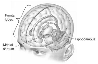 Hipokampus případ H.M.