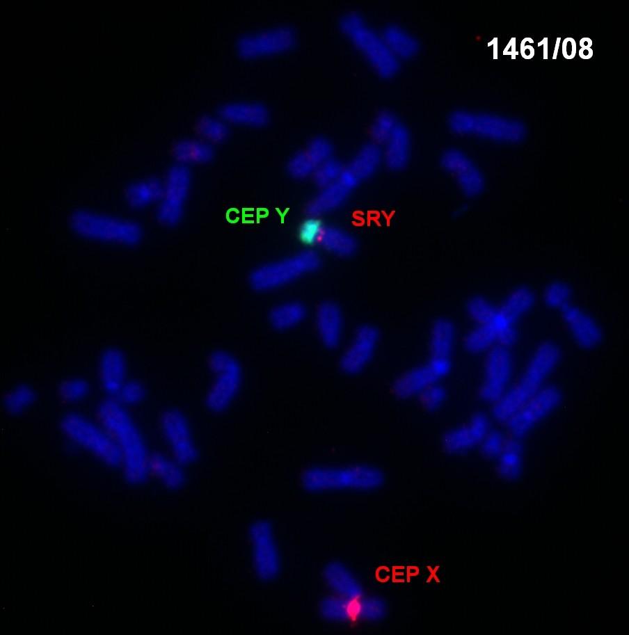 VROZENÉ CHROMOSOMOVÉ ABERACE (VCA)