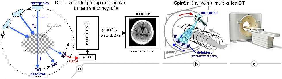 Rozdílná absorpce prošlého záření je převedena na elektrický impuls, který se registruje v počítači (Kalvach, 2010, s. 173). Obrázek3.