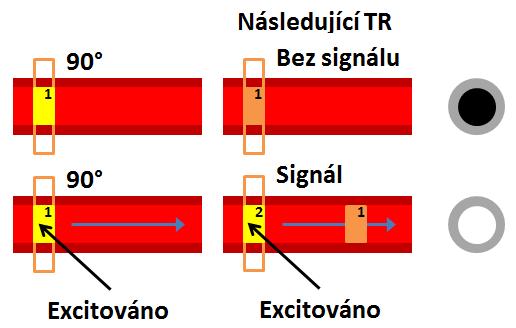 mapa (Seidl, 2012, s. 67). Pomocí DWI a PWI sekvence je moţné včas stanovit průkaz mozkové ischemie jiţ po 20 minutách od vzniku poškození (Vomáčka, 2012, s. 55).