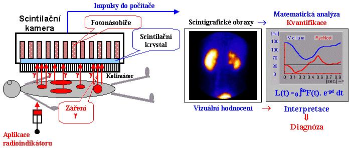 8.6 Nukleární neurologie Pomocí nukleárních vyšetření je moţné hodnotit funkční projevy mozkové tkáně.