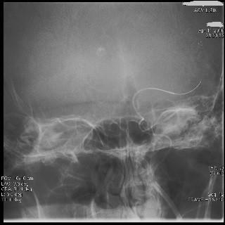 Zdroj Archiv Radiologické