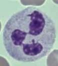 Basophil Eosinophil Neutrophil