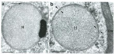 2. Úvod Řada anaerobních či mikroaerofilních eukaryot jako jsou někteří nálevníci (např. Nyctotherus ovalis), chytridiomycetní houby (např. Neocallimastix a Piromyces) či parazitičtí bičíkovci (např.