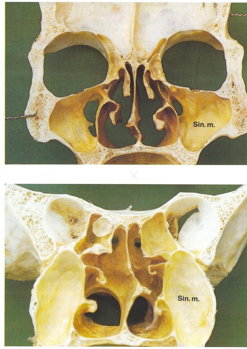 Pohled odzadu vpřed: široká a nižší čelistní dutina, střední skořepa se upíná k bazi lební lamina cribrosa Pohled vzad: vysoké a