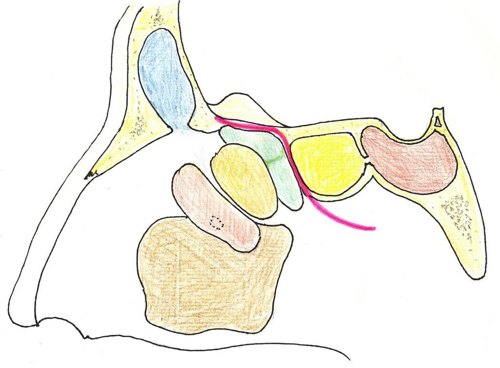 Schéma laterální nosní stěny po odstranění střední skořepy sinus frontalis crista galli zadní etmoidy sella turcica r.s. recessus frontalis r.