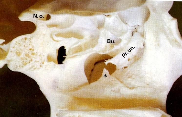 Skelet laterální stěny dutiny nosní. Dorzálně od proc.