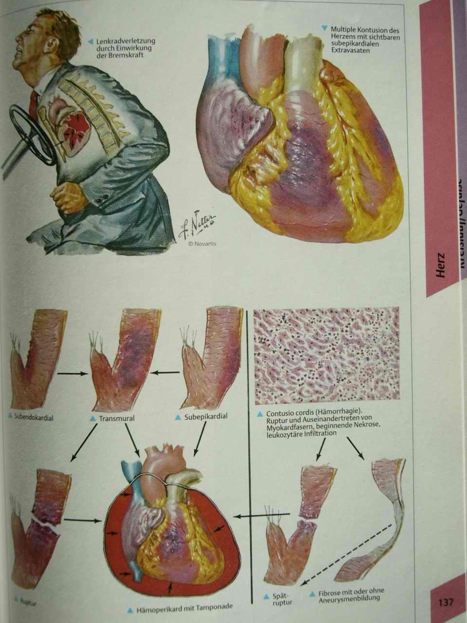 Srdeční