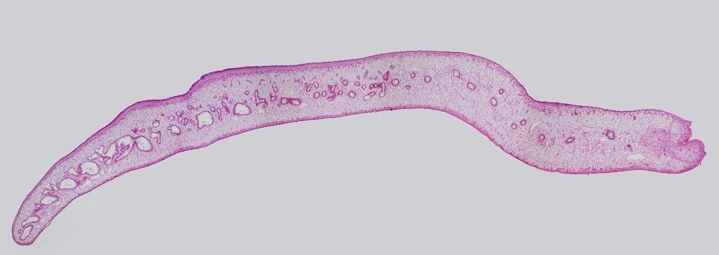 A H T S ÚP V 1 mm B T S K S V V V V Obr. 13: Histologický řez motolice F.