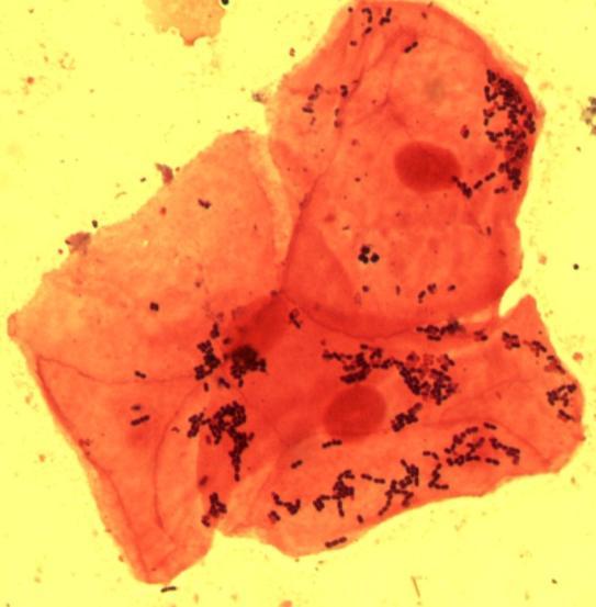 pacienta. Citlivost na antibiotika byla měřena v rámci standardního laboratorního vyšetření a znovu ověřena během této studie.