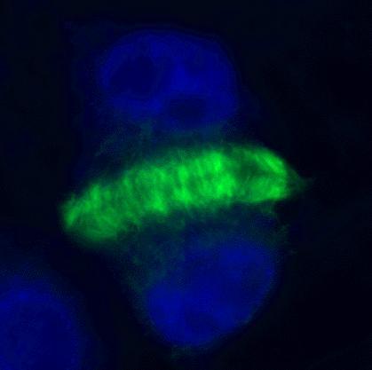 Fluorescenční mikroskopie