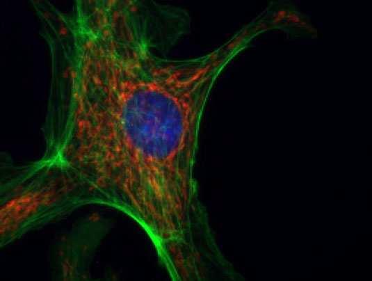 Fluorescenční mikroskopie Fluorescenční mikroskopie endoteliálních buněk za použití tří fluorescenčních značek.