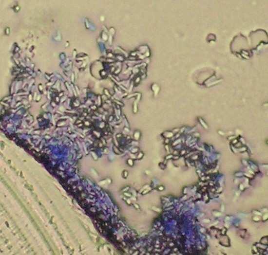 Význam tvorby biofilmu u bakterií Bakterie mohou lépe regulovat početnost populace v rámci biofilmu se totiž informují produkcí určitých látek (tzv.