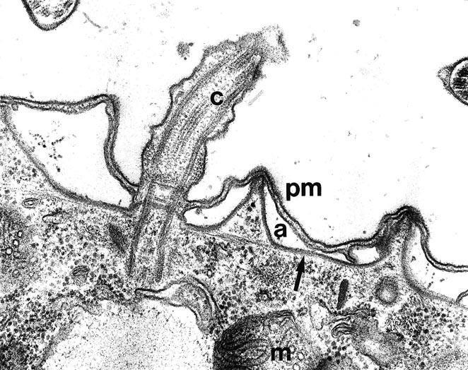 3. ALVEOLATA Povrch buňky vyztužují kortikální alveoly měchýřky pod cytoplasmatickou membránou (na obrázku označeno a).
