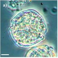 3.1.3. Heterotrichea Spirostomum ambiguum Obrovský sladkovodní nálevník dosahující délky několik milimetrů. Buňka je velmi kontraktilní, obsahuje mnoho menších makronukleů.