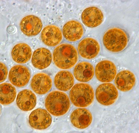 - symbiotická obrněnka vytvářející zooxantely v korálu Acropora tenuis. Izolováno z velkého korálového útesu u Austrálie. 3.3. Chromerida Chromera velia kulovité buňky, vytváří cysty po 2-4.