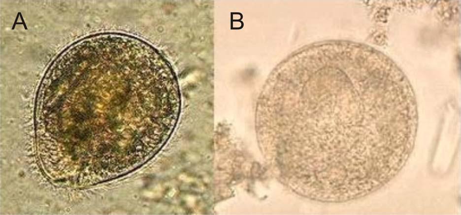 střeva prasat, koní, primátů a psů (Nakauchi 1999; Headley et al. 2008). Další druhy rodu Balantidium nalezneme téměř u všech ţivočichů, například v plazech, obojţivelnících (Li et al.