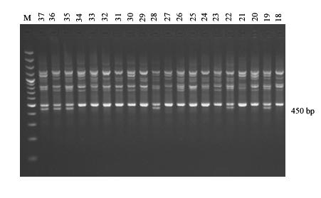 Detekce genu Pl1 Detekce genu Pl1 byla realizována pomocí dominantního RAPD markeru navrženého MAKRUSEN et al. (1995). Pro dominantní alelu je charakteristická přítomnost fragmentu o velikosti 450 bp.