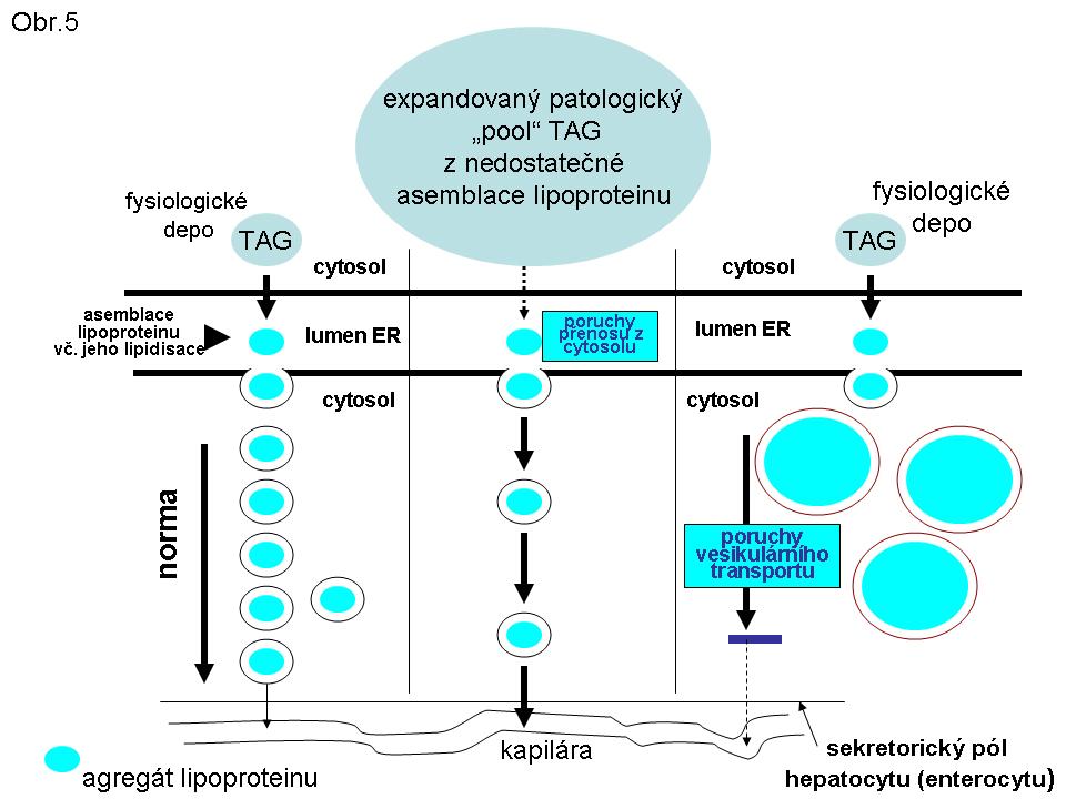 Obr. 5. Schema základních mechanismů steatos daných poruchami syntesy a sekrece lipoproteinu II. Mitochondriální beta-oxidace (BOX) mastných kyselin (MK) a její poruchy (na této části se podílel ing.