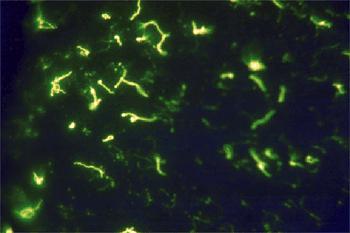 Imunofluorescence jedna složka značena fluorescenčním barvivem, průkaz pomocí fluorescenčního mikroskopu přímá průkaz