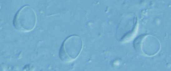 1. Giardia