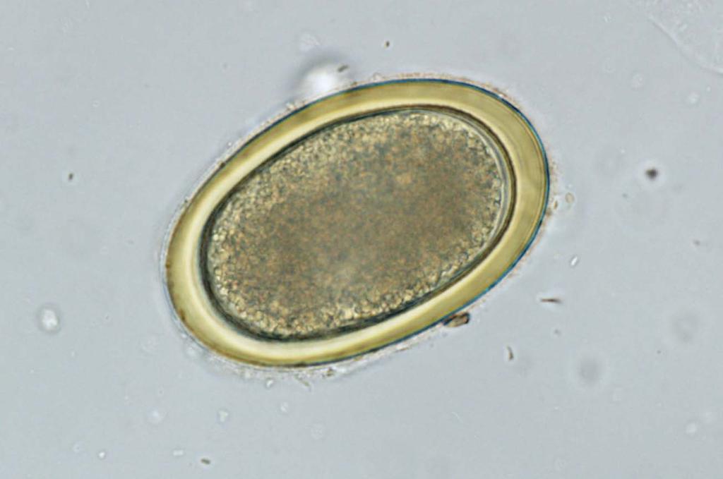 BČ 20 µm 3.