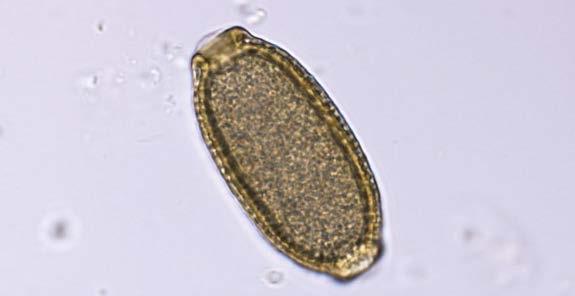 Capillaria