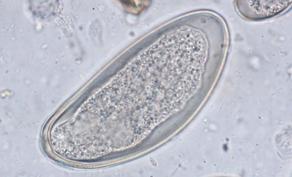 BČ 50 µm 2.