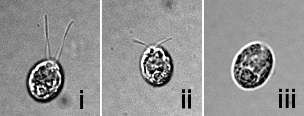 a b c Ktoré z nasledovných tvrdení je podporené výsledkom pozorovania buniek inkubovaných s cykloheximidom? a. Všetky proteíny inkorporované do regenerovaného bičíka sú syntetizované de novo. b. De novo syntéza proteínov je esenciálna pre kompletnú regeneráciu bičíka.