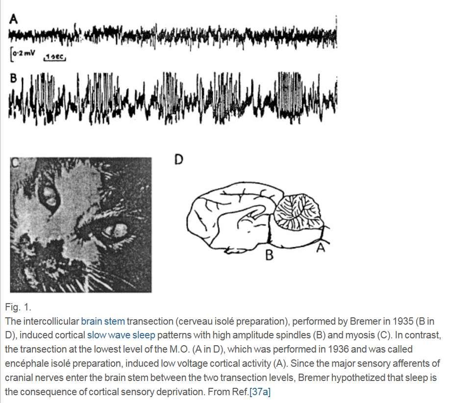 EEG korová aktivita EEG nonrem spánek s vřeteny Bremer, F.