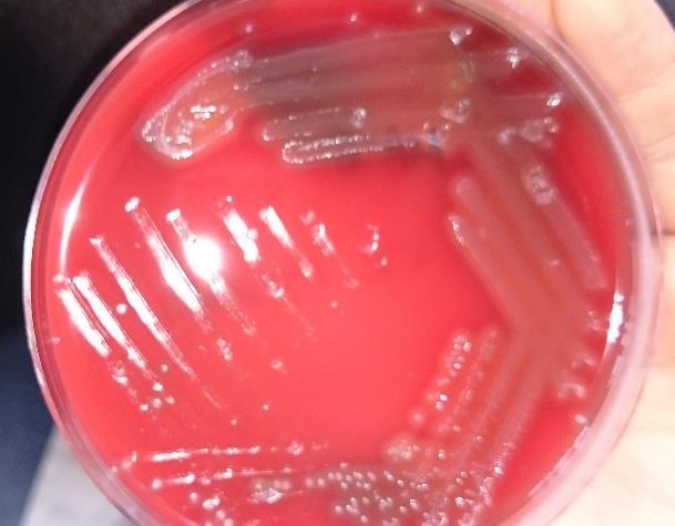 Streptococcus pyogenes Streptococcus agalactiae Serratia marcescens