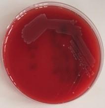 4: Germ-tube test (GT test) Je to test založený na schopnosti Candida
