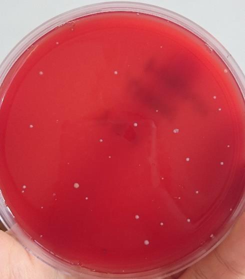 Úkol č. 5: Kontrola mikrobiologické čistoty ovzduší Orientační stanovení SPAD. 1.