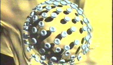HIV SARS Severe