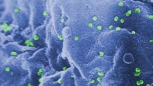 HIV budding