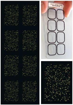 KDO (neuroblastom) Od roku 2009 44K Agilent