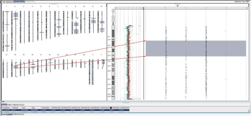 Konsangvinita CGH+SNP arrays Parciální UPD >