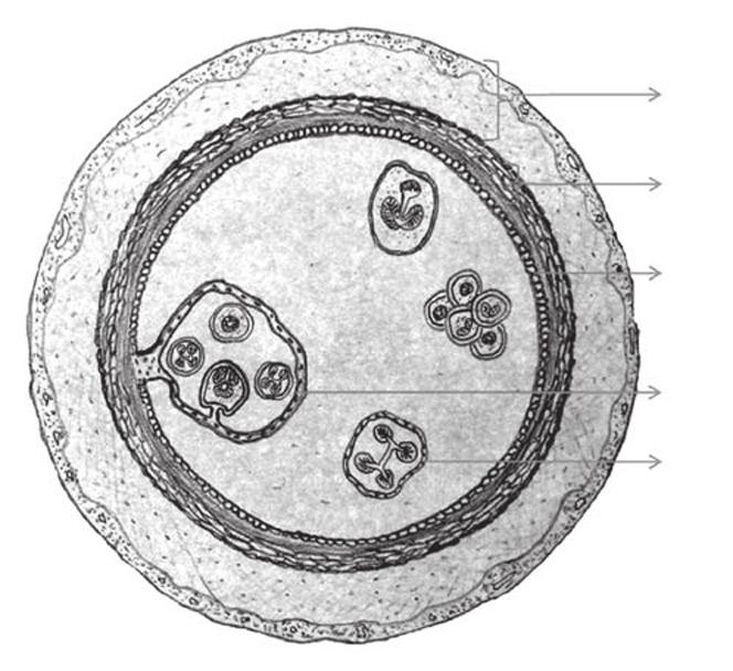 Obrázek 1 Životní cyklus Echinococcus granulosus Obrázek 2 Schéma hydatidózní cysty defi nitivní hostitel (masožravec) dospělá tasemnice zralá cysta infekční vajíčko D mezihostitel náhodný