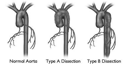 Ak kargiológ, ku ktorému bude pacient chodiť, nemá k dispozícii echoklardiografickú diagnostiku, treba pacienta poslať ďalej. Je veľa parametrov, ktoré treba zmerať.