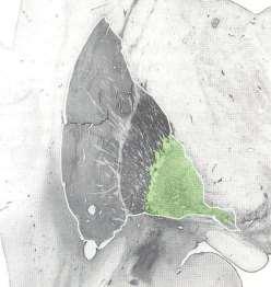 Pallidum externum + Pallidum internum Pu Th Pu Th