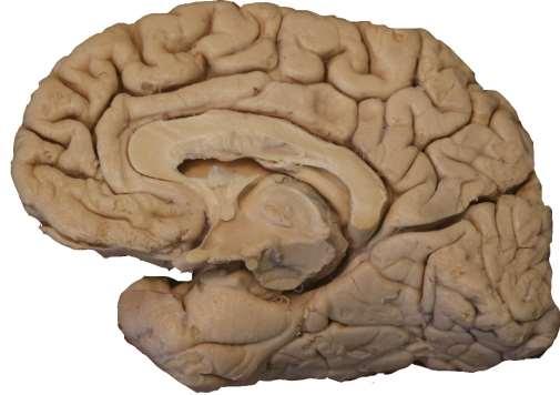 Telencephalon koncový mozek 1) Kůra (cortex) Kůra šestivrstevná neocortex - 95% Kůra trojvrstevná paleocortex čichová archicortex hippokampální formace Přechody mesocortex např.