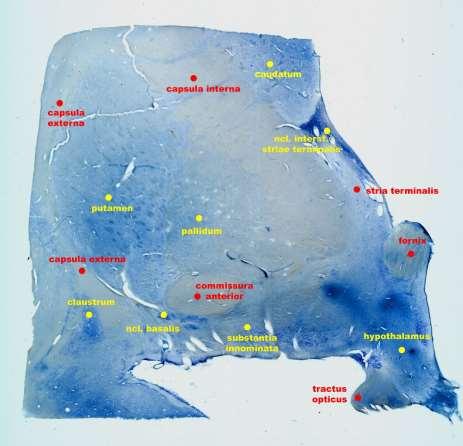 Substantia innominata Oblast basálního telencephala
