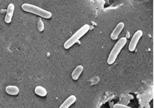Minimální velikost genomu: (b) Experimentální přístup Knock-out 79 náhodně vybraných genů Bacillus subtilis: - pouze 6 letálních, 73 je postradatelných 7.5% (6/79) genomu je nepostradatelných - B.