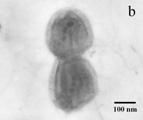 Nukleocytoplasmické velké