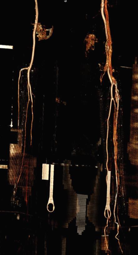 Afi l.sin.